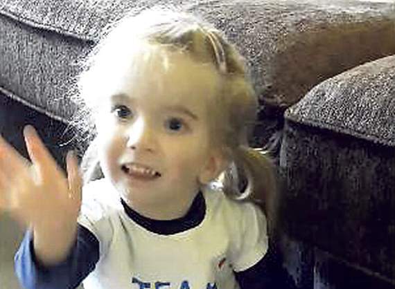 Three-year-old Elena has Russell Silver Syndrome
