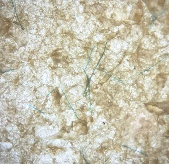 Polypropelyne fibres, most likely from a fishing net, found in the stomach of a Blue Olefin shark. Photo by Kristian Parton
