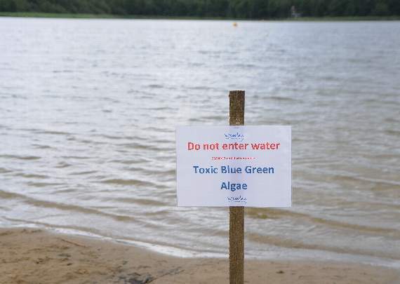 Toxic blue-green algae can cause dermatitis, eye irritation and rashes