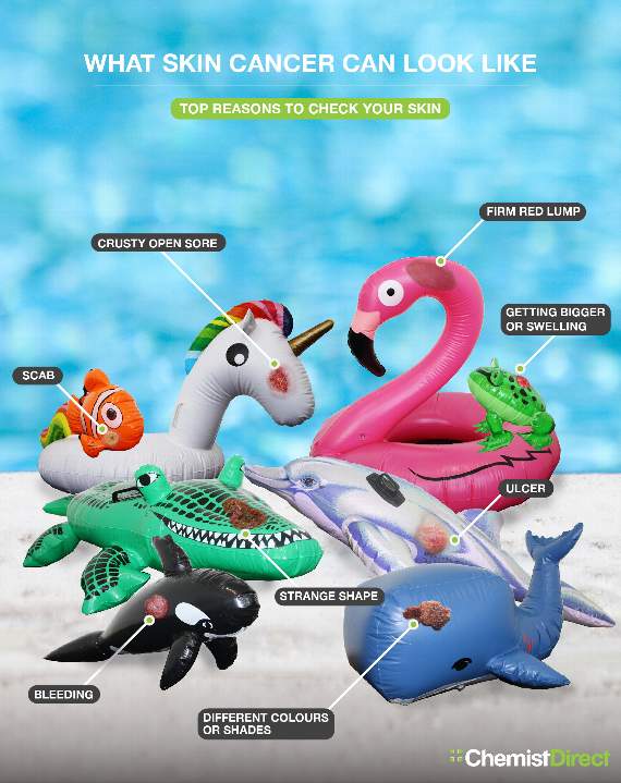 Chemist Direct: Some common symptoms of skin cancer to look out for