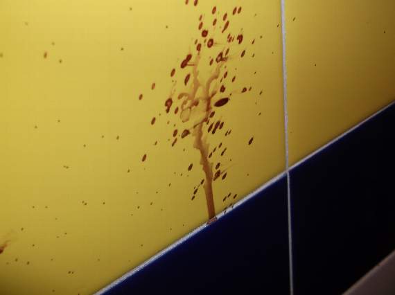 Blood spattered on a wall