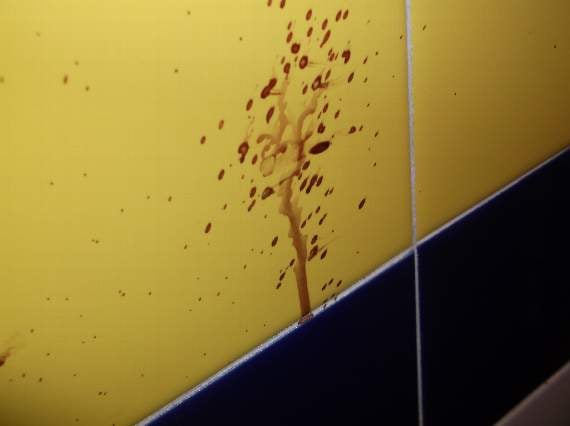 Blood spattered on a wall