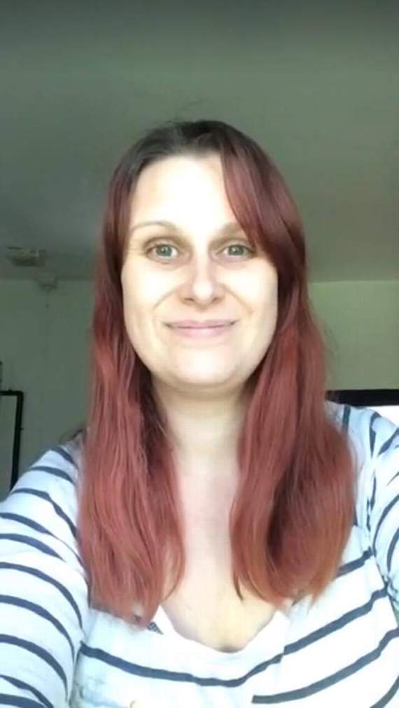 Emily Morgan before and after the charity head shave.