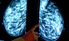 Tens of thousands of Surrey women miss “vital” breast cancer screening