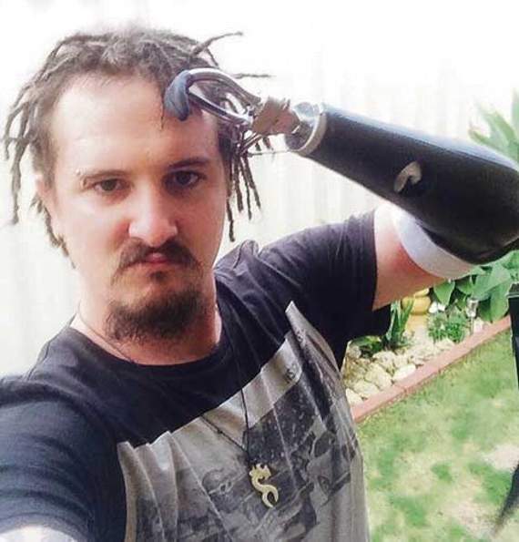 Ross salutes his friends and family for fundraising efforts to help him buy a new arm.