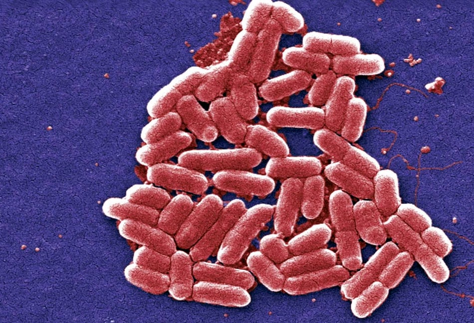 <p>A study has found increases in salmonella cases could be linked to climate change. (Stock image)</p>