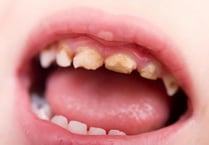 Vote on fluoridation pushed back to next Tynwald sitting