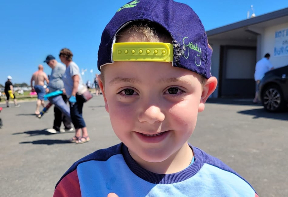 <p>Oscar Hutton, then aged three, fell 12 feet onto a tiled floor at his grandparents’ home in May 2019</p>