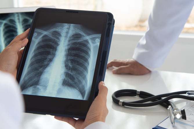Doctor diagnose lung x-ray image on digital tablet screen with radiologic technologist team.