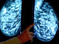 Breast screening uptake in east Berkshire, north east Hampshire, Farnham and Surrey Heath remains below pre-pandemic levels
