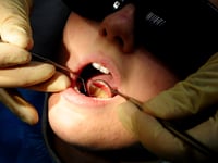 Dozens of hospital admissions in Waverley to remove children's rotten teeth