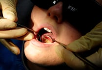Dozens of hospital admissions in Waverley to remove children's rotten teeth