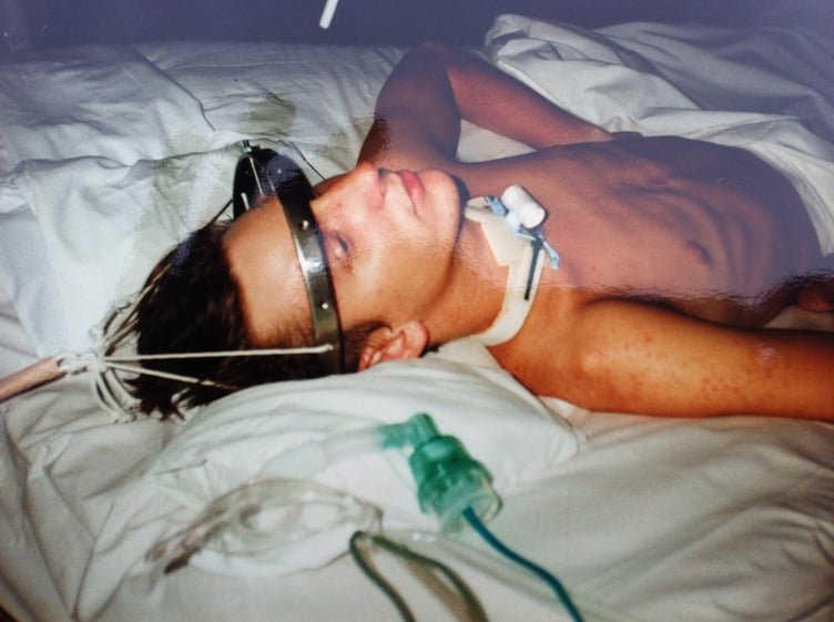 Steven Webb in Salisbury Hospital after his accident in 1991