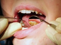 Nearly a quarter of people in the Surrey heartlands struggle to get an NHS dentist appointment