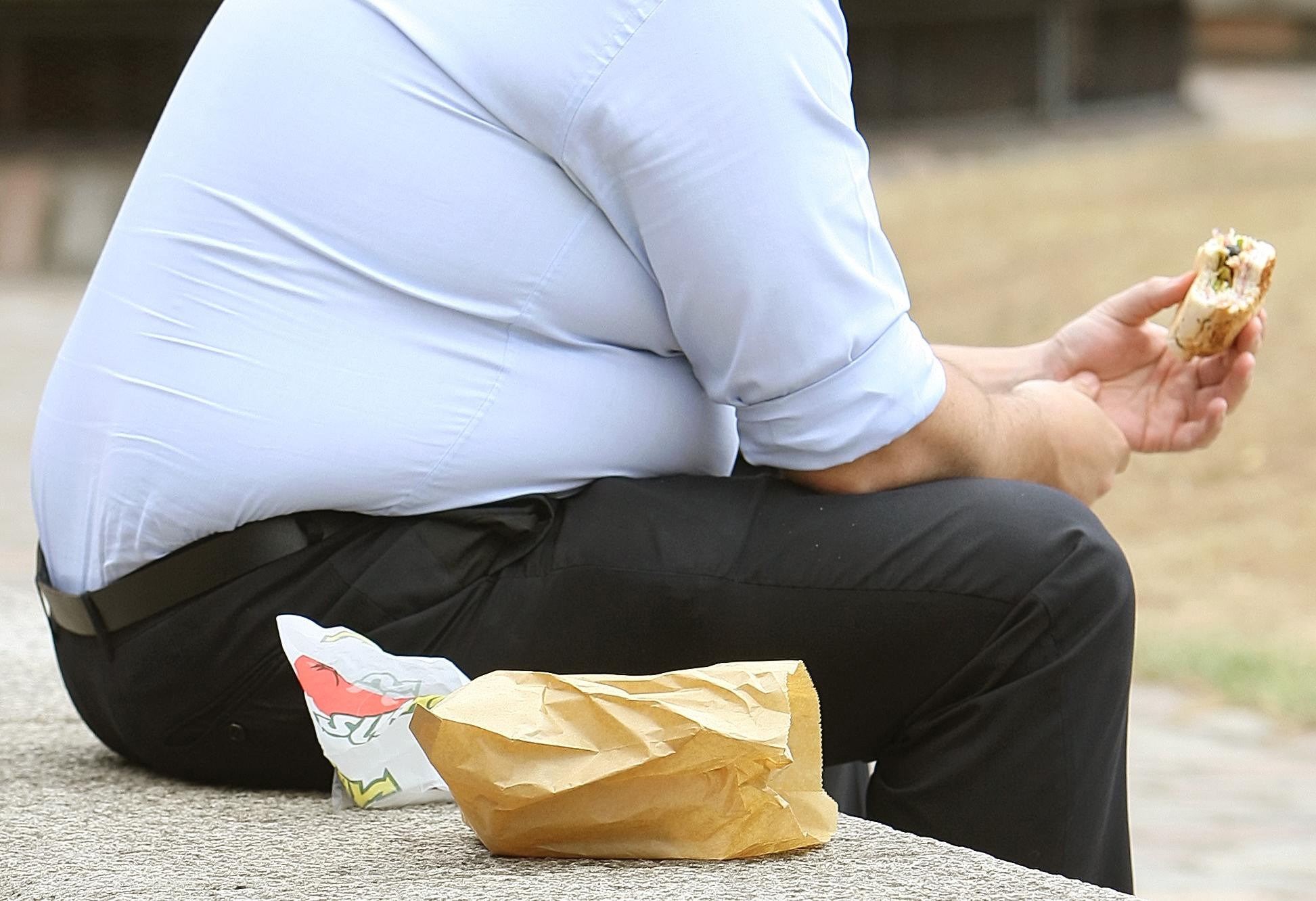 Obesity admissions in Surrey rise slightly over the last year
