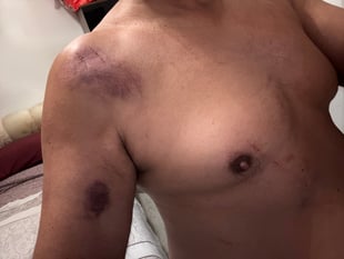 Walker claims he was mauled by ‘leopard’ in Surrey Hills attack