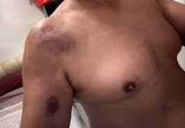 Walker claims he was mauled by ‘leopard’ in Surrey Hills attack