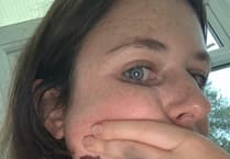 'Girls' holidays in the sun probably caused my skin cancer'
