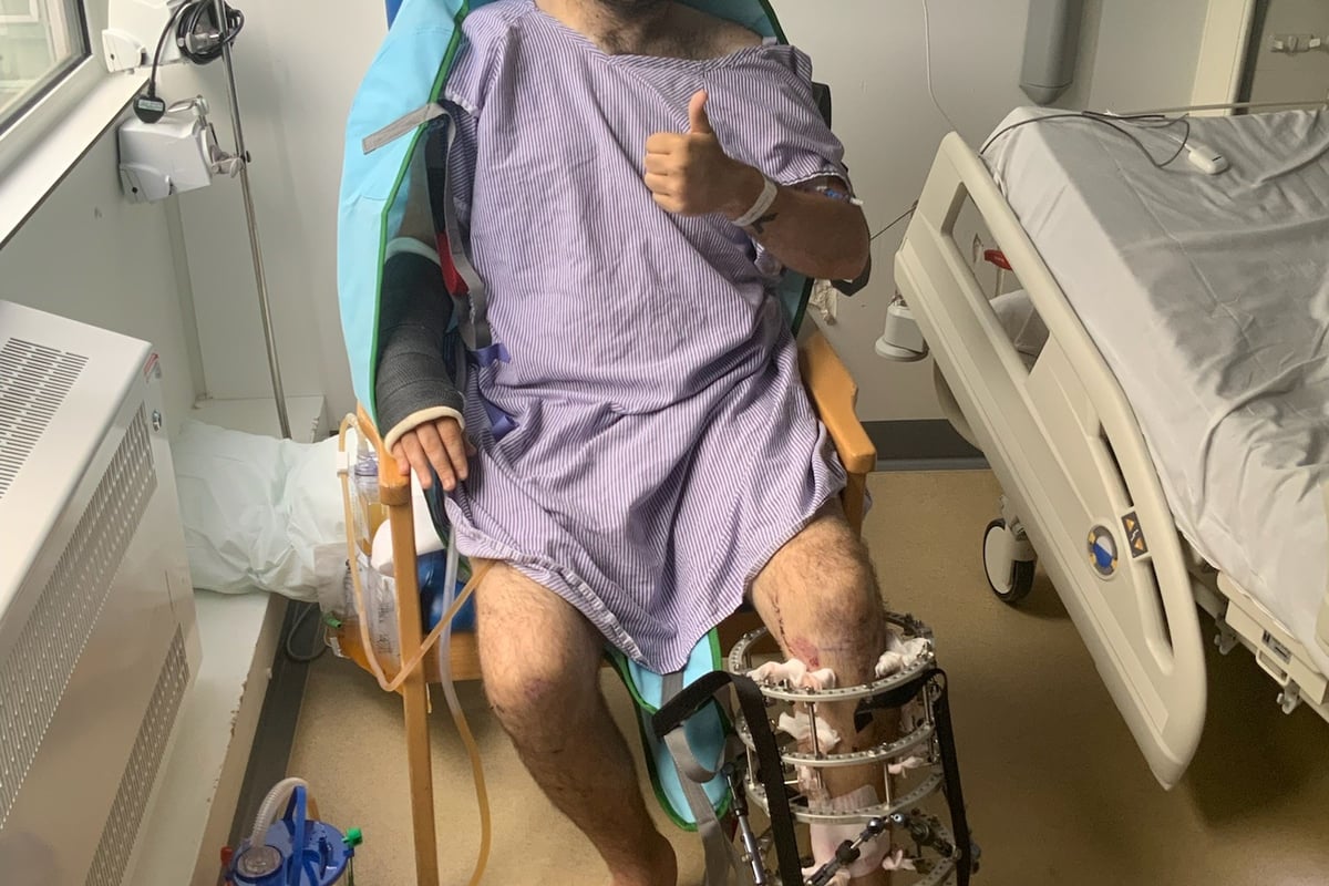 Alton father turns life-changing accident into support for others